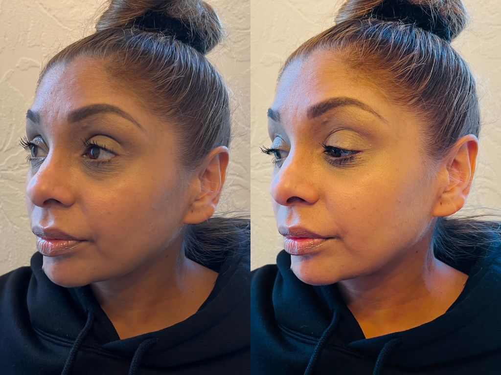 Before and after Tatcha SPF | Space NK