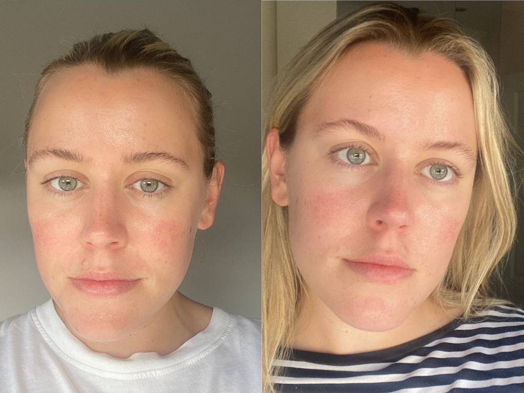 Rachel-Louise's Before and After Charlotte Tilbury Magic Water Cream Review | Space NK Rachel-Louise's Before and After Charlotte Tilbury Magic Water Cream Review | Space NK