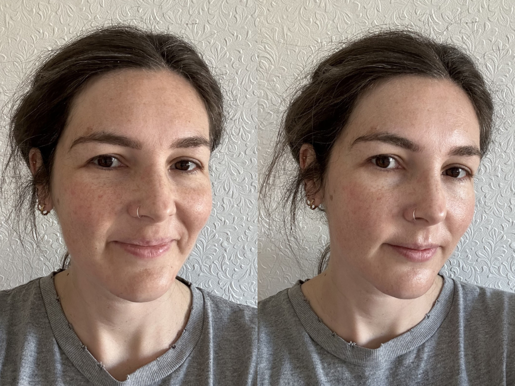 Before and after Dr Barbara Glow Cream | Space NK