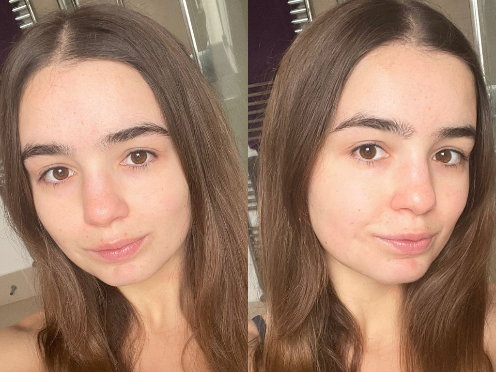 Before and after Medik8 Total Moisture Facial Cream | Space NK
