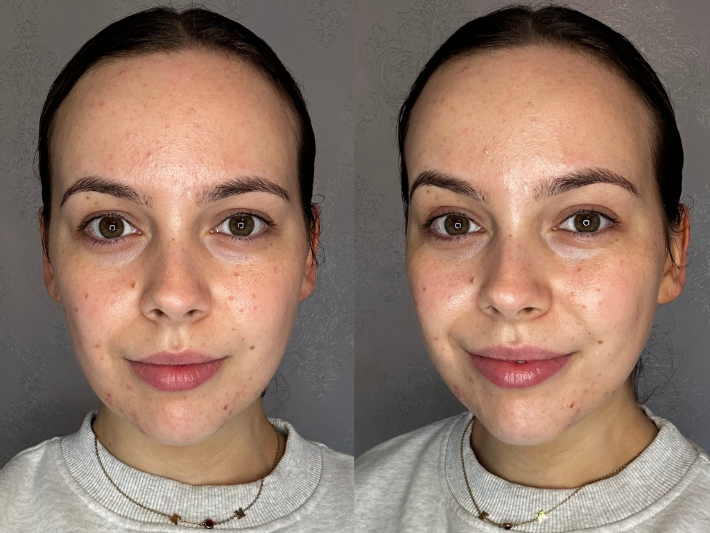 Before and after Dr Barbara Glow Cream | Space NK