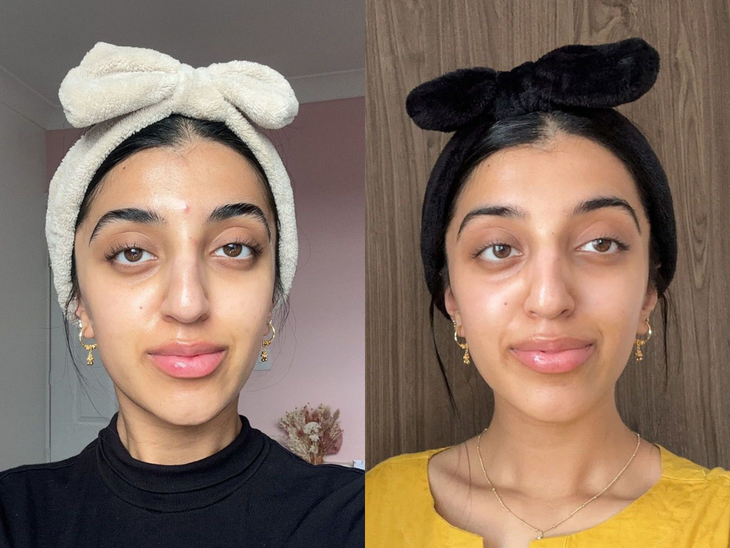 Sehar's Before and After Charlotte Tilbury Magic Water Cream Review | Space NK Sehar's Before and After Charlotte Tilbury Magic Water Cream Review | Space NK