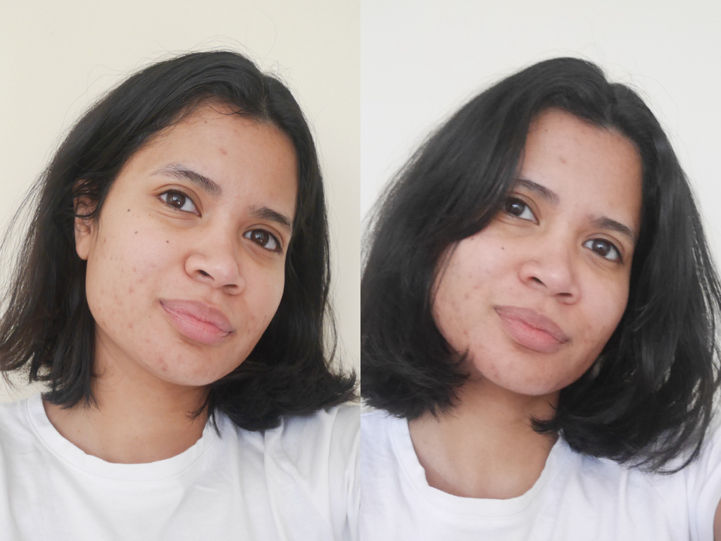 Before and after using Dr Dennis Gross peel pads | Space NK Before and after using Dr Dennis Gross peel pads | Space NK