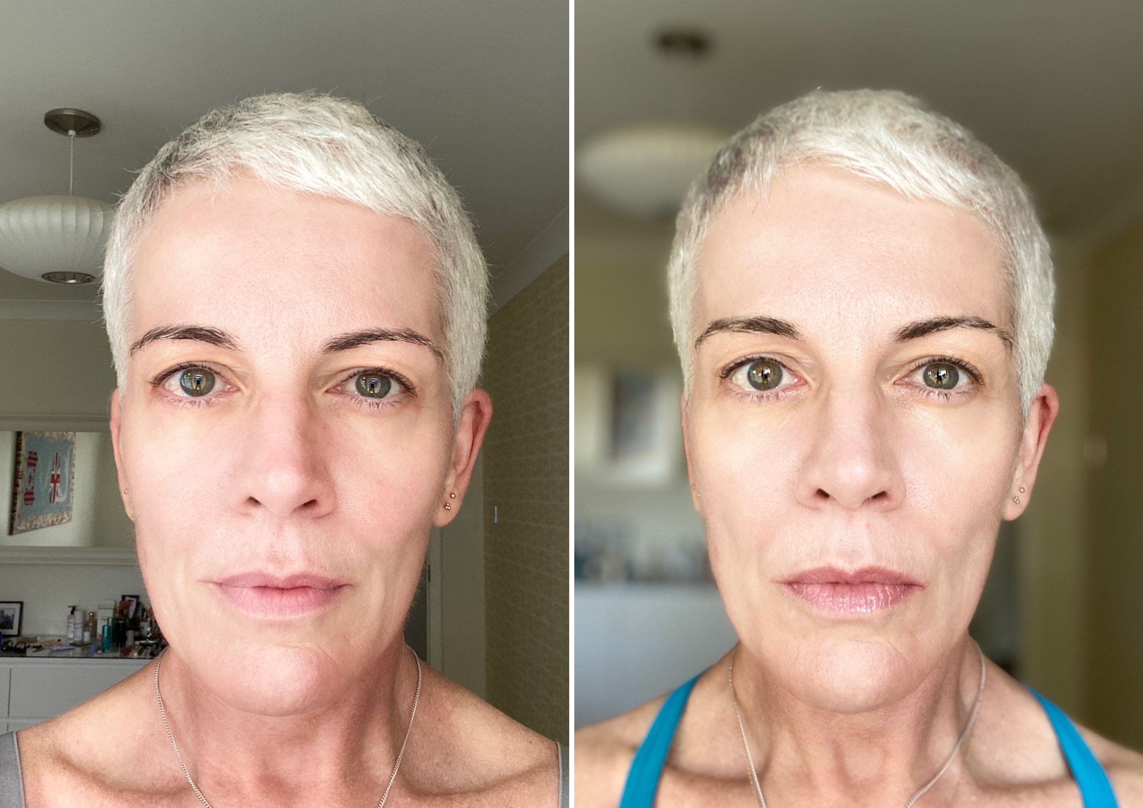 Lynn's Tatcha The Longevity Serum Before And After