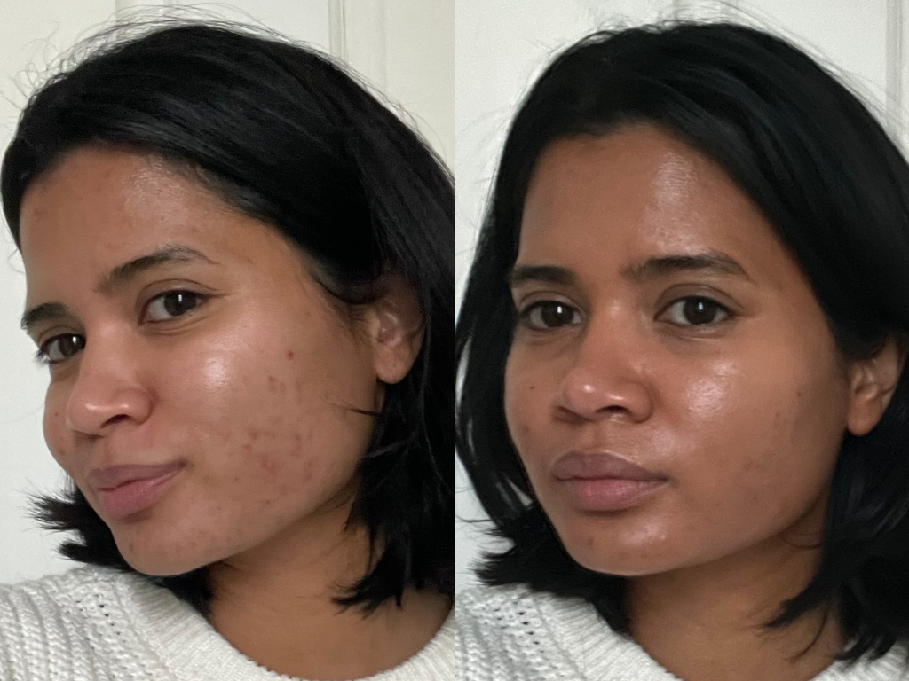 Hanitra's before and after Ilia Skin Tint | Space NK