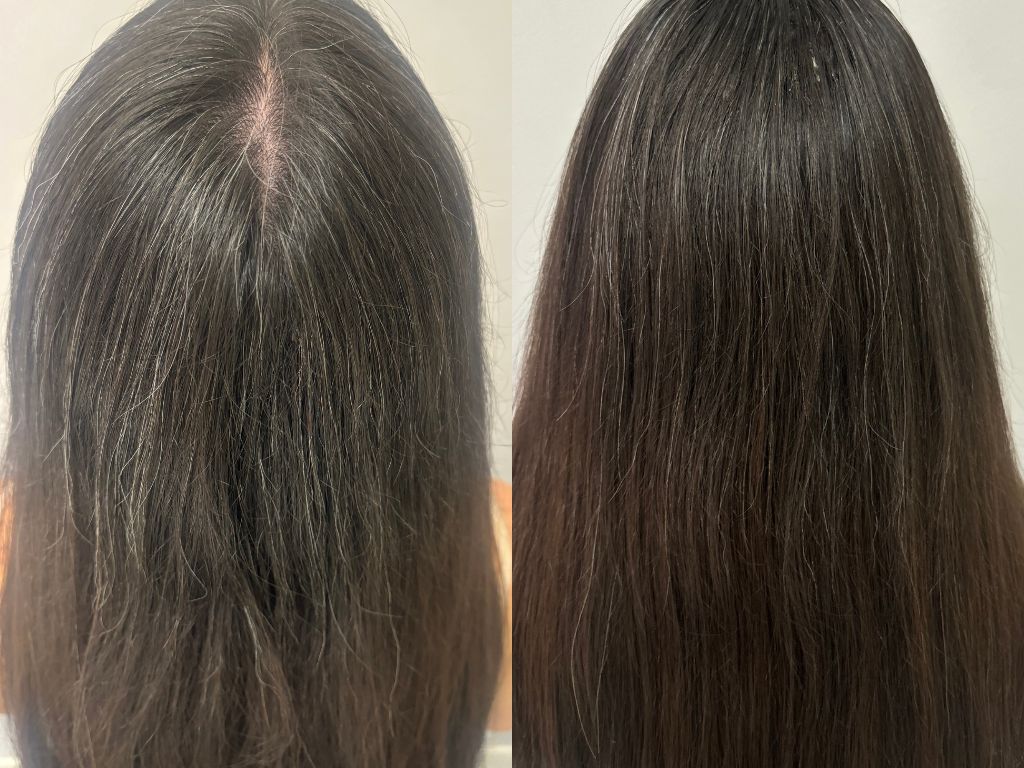 Ella's side by side progress Ella's side by side progress