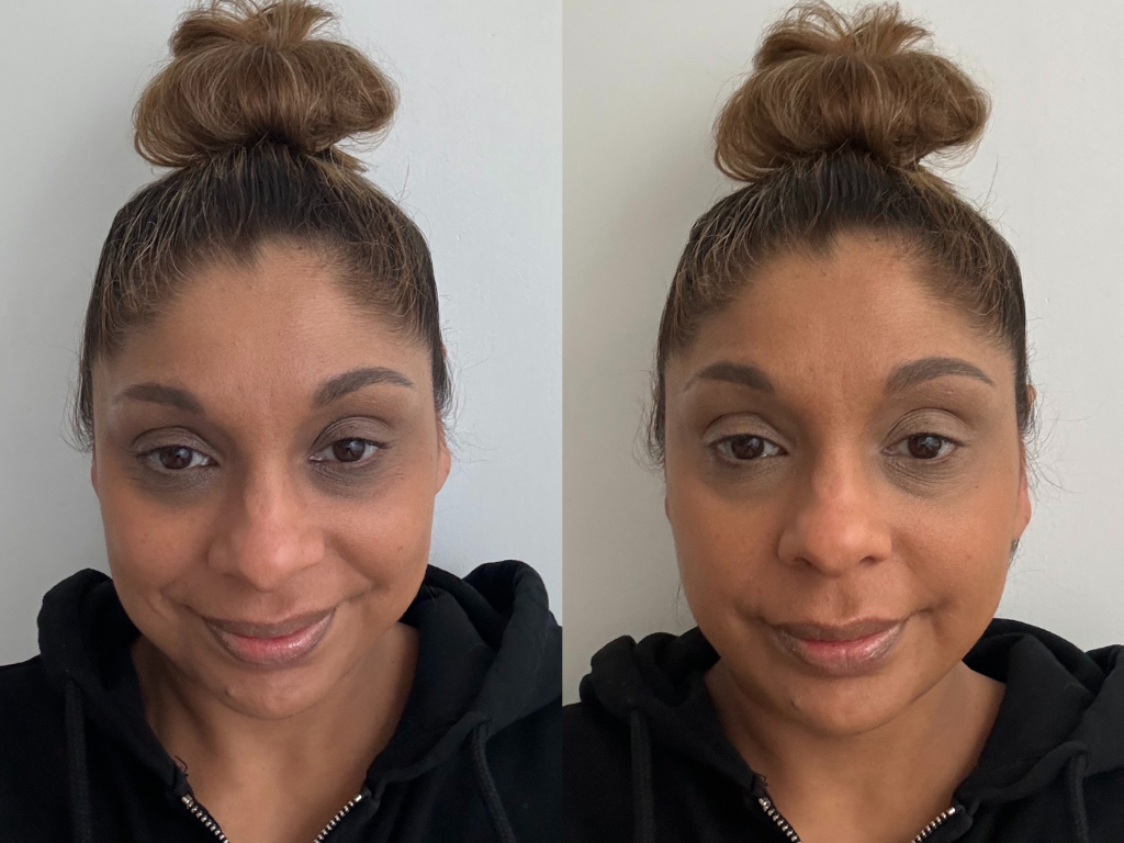 Before and after Erborian Super BB Concealer | Space NK Before and after Erborian Super BB Concealer | Space NK