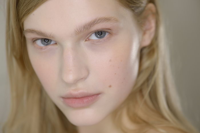 How To Reduce Acne Scarring How To Reduce Acne Scarring