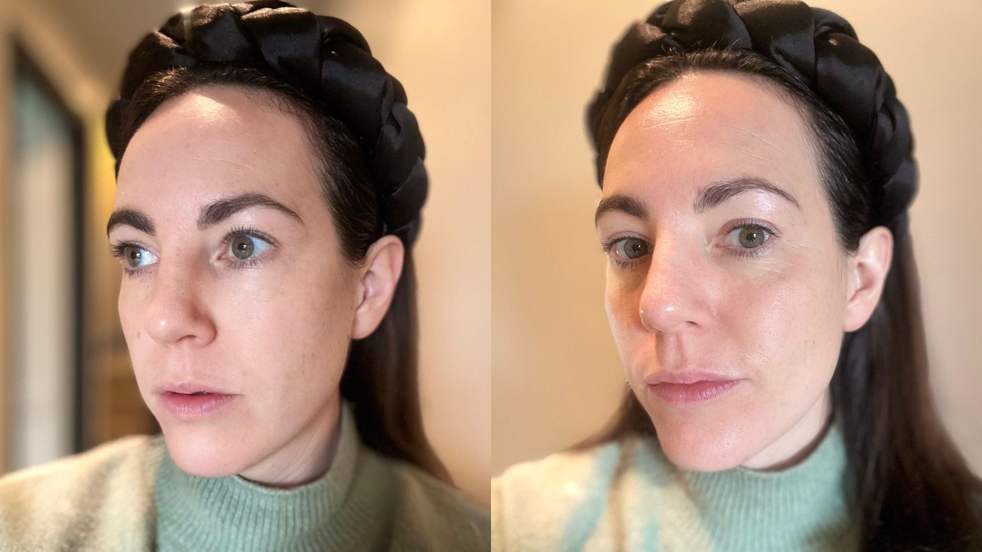 Felicity before and after using The Ordinary Multi-Active Delivery Essence | Space NK