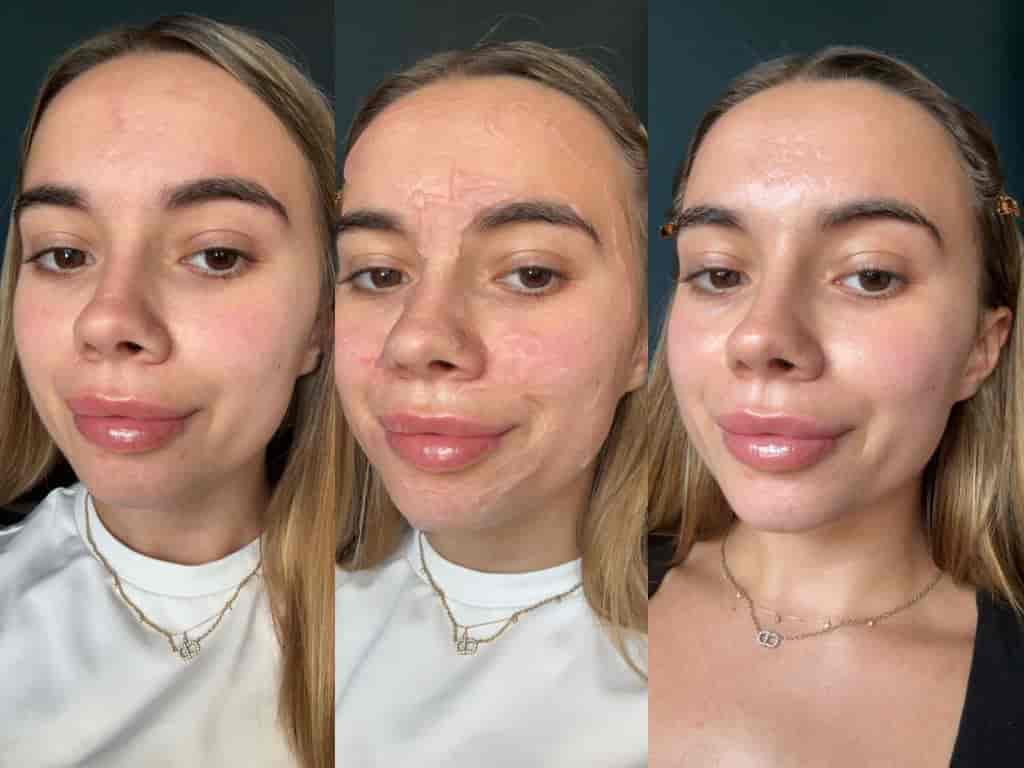 Isabel's Dr. Jart+ Cryo Sorbet Icy Facial Mask review | Space NK