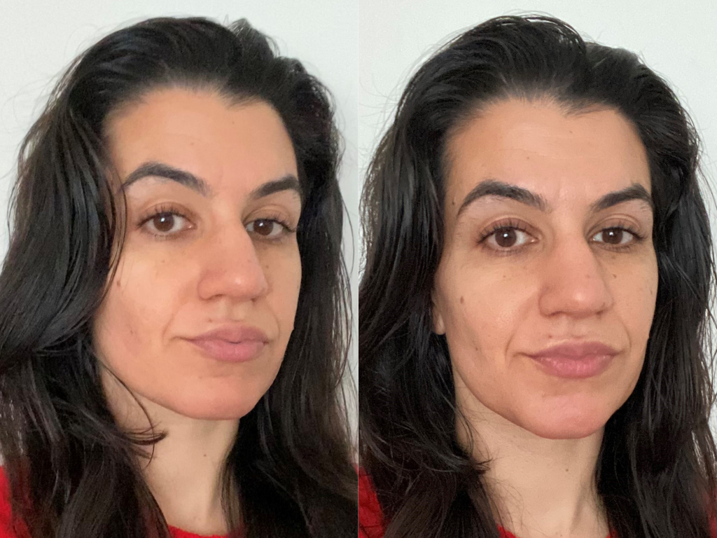 Fresh Lotus Dream Serum before and after | Space NK Fresh Lotus Dream Serum before and after | Space NK