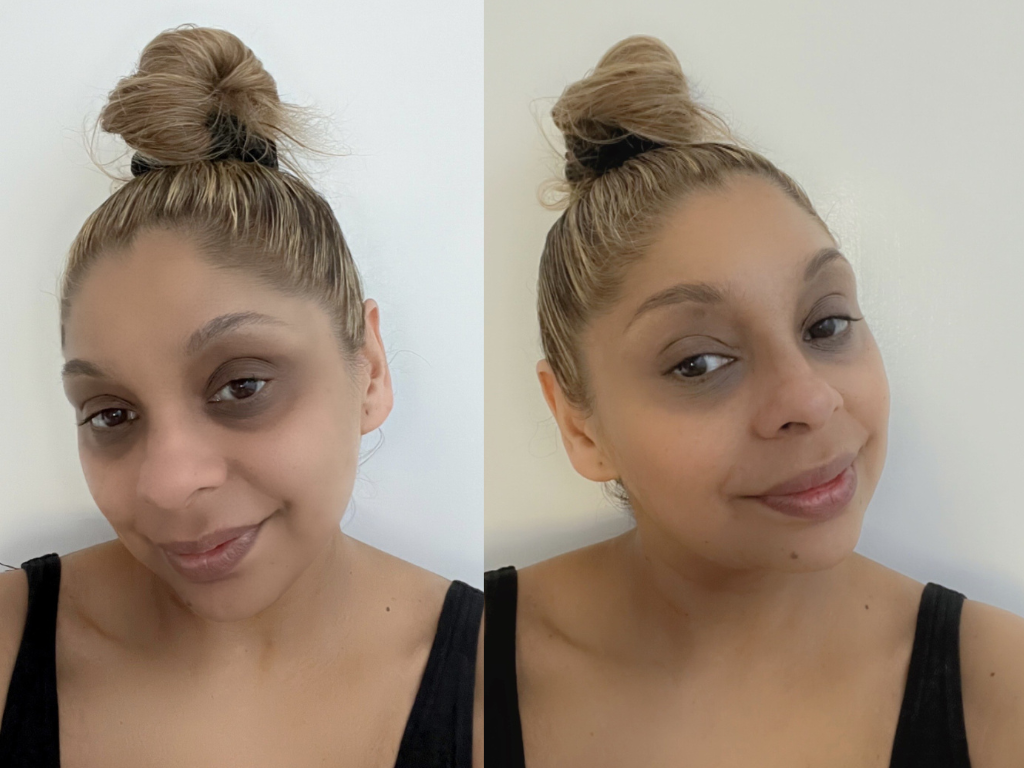 Before and after Medik8 Total Moisture Facial Cream | Space NK Before and after Medik8 Total Moisture Facial Cream | Space NK