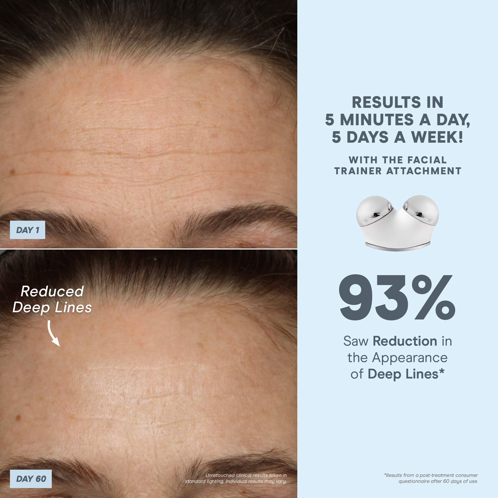 Nuface Trinity+® Complete Facial Toning Kit King's Cross