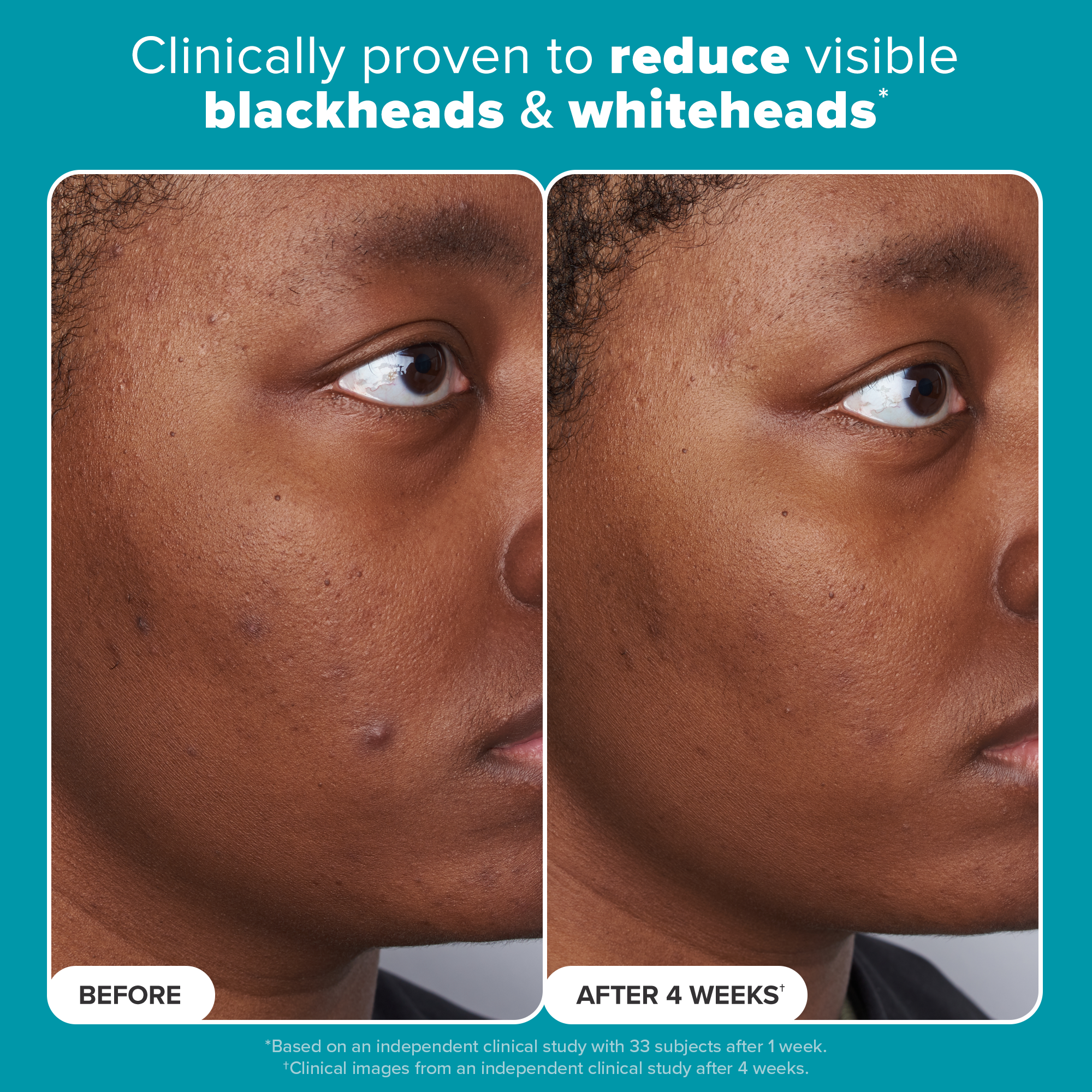 Paula's choice exfoliant discount