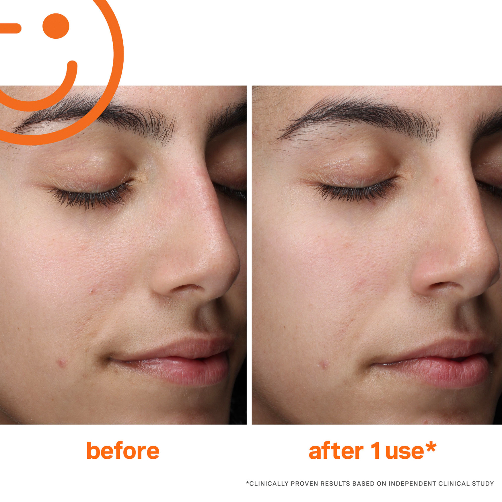 Kate Somerville Exfolikate Cleanser Daily Foaming Wash