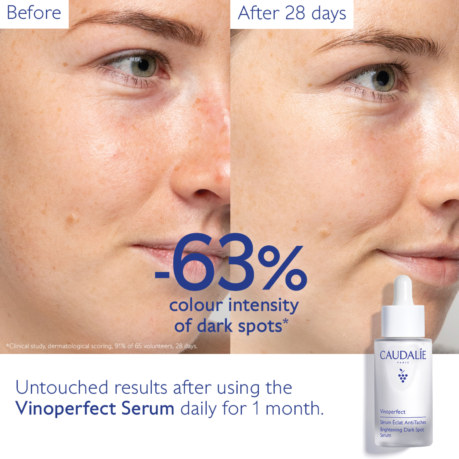Caudalie Vinoperfect Brightening Dark Spot Serum Vitamin C 