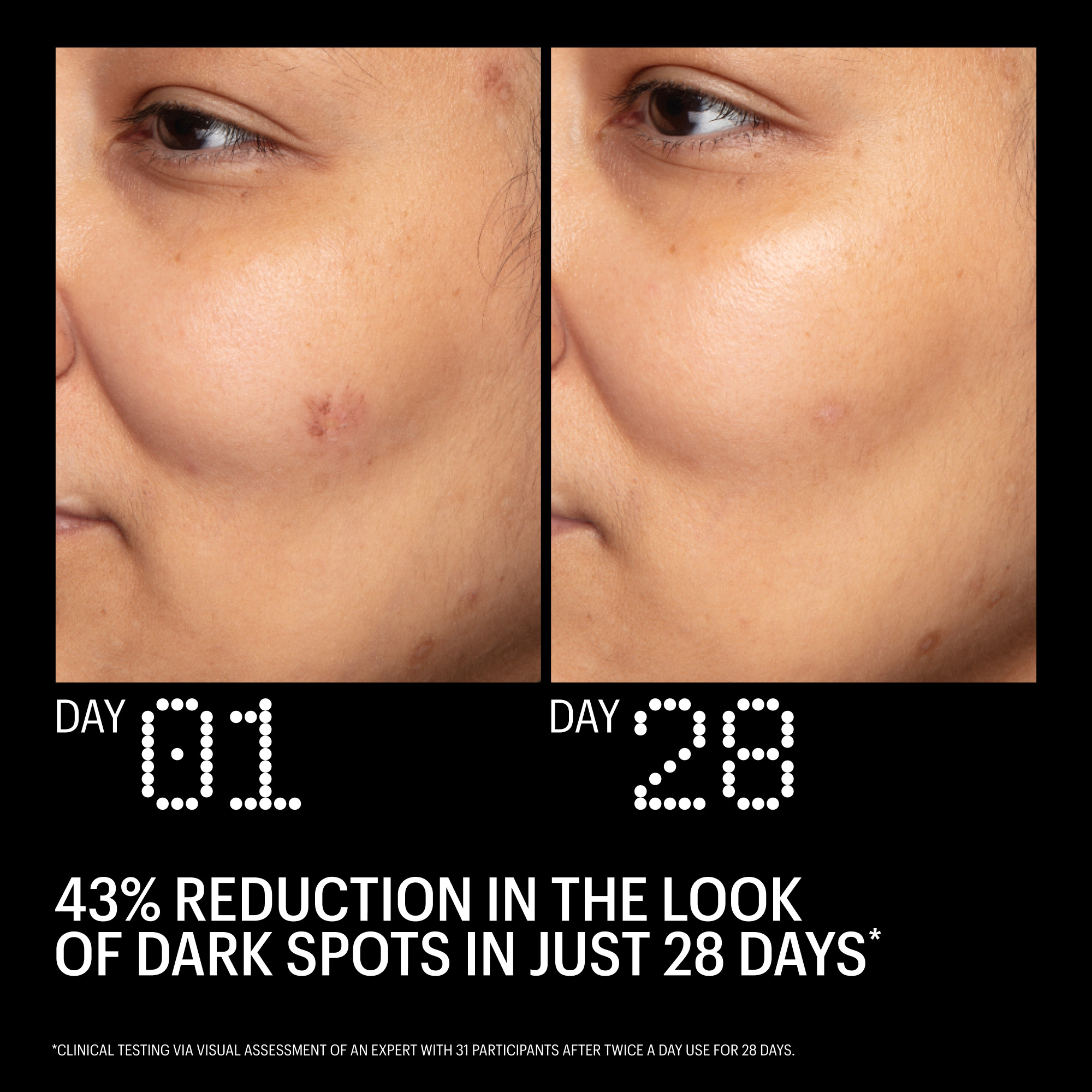 Allies of Skin Azelaic & Kojic Advanced Clarifying Serum | Space NK