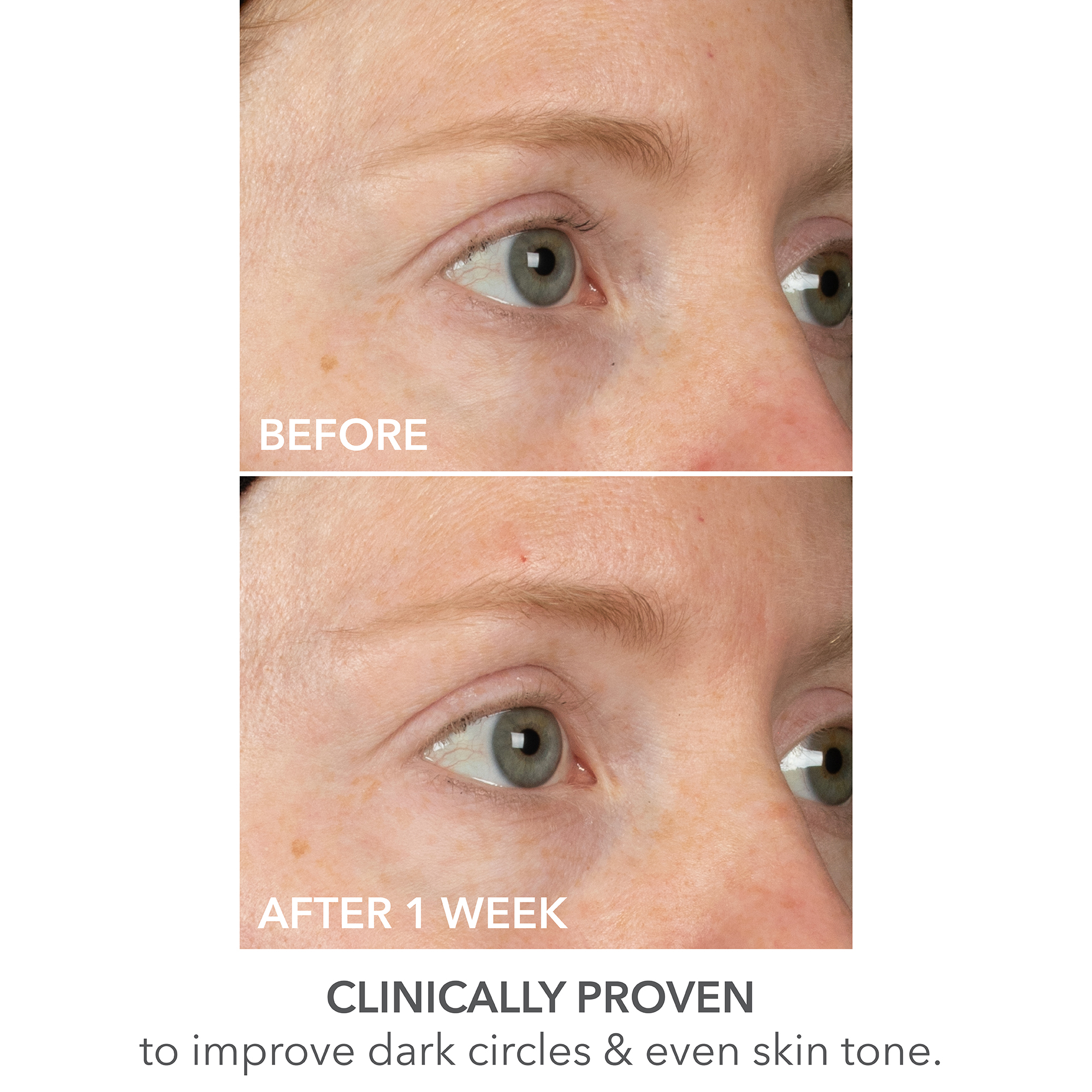 Dr. Dennis Gross DermInfusions Lift + Repair Eye Mask | Space NK