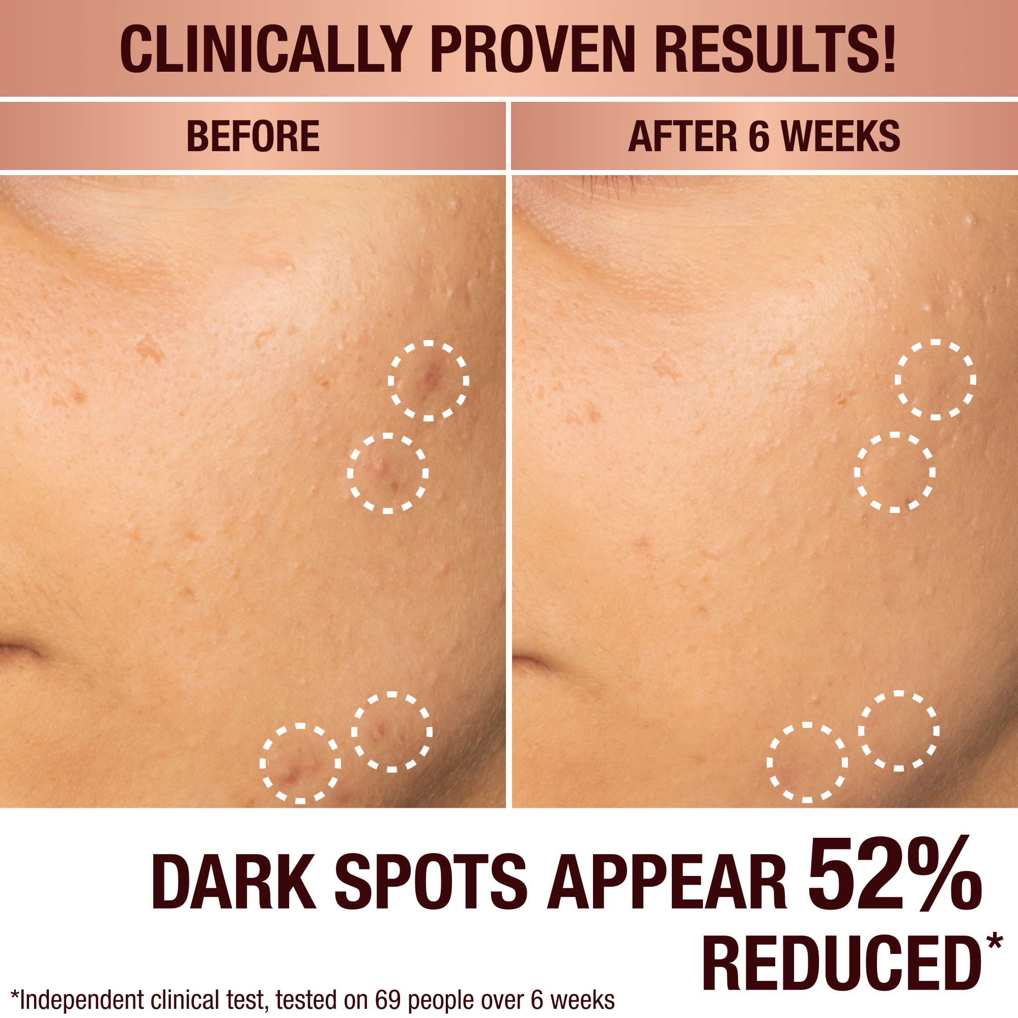 Charlotte Tilbury Dark Spot Correcting Radiance Recovery